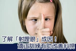 雙眼斜視|斜視：成因、病徵及治療